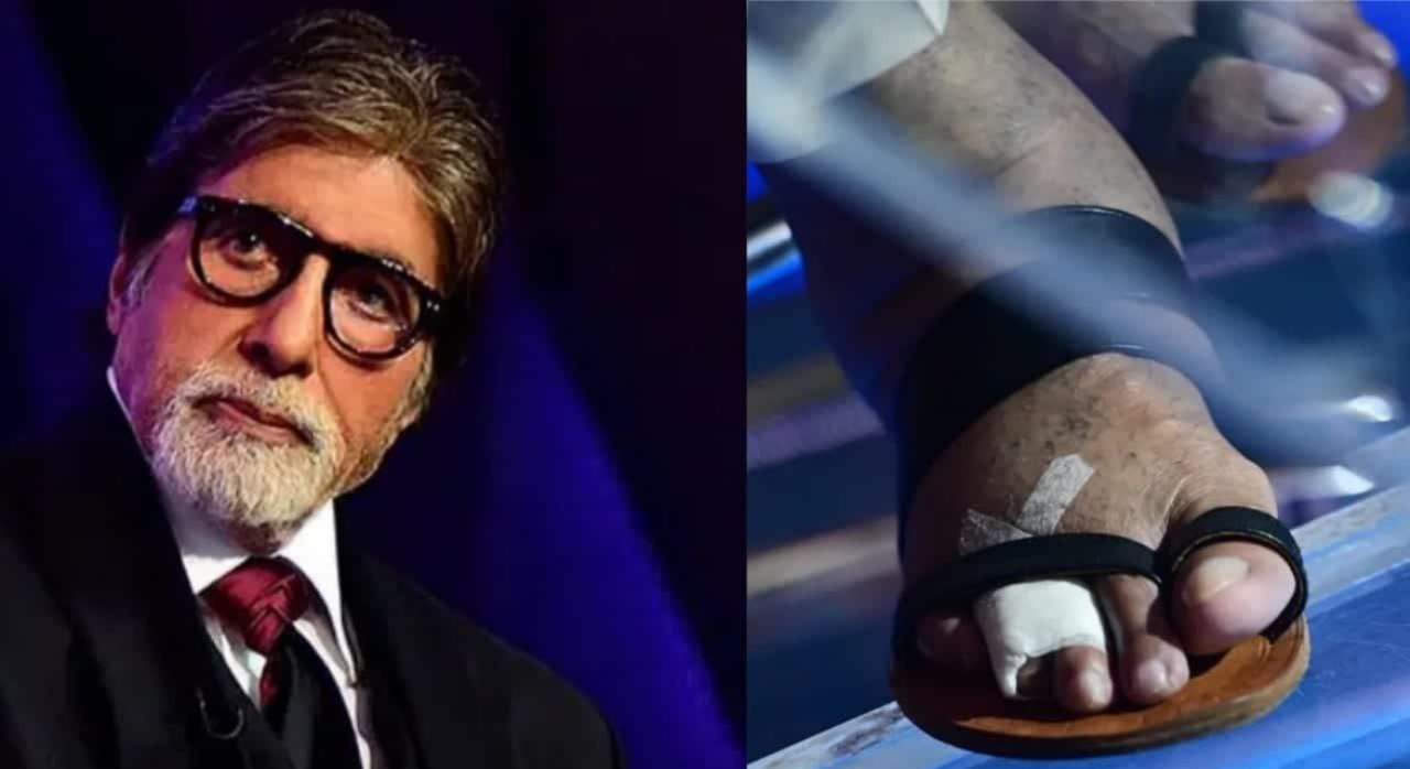 अमिताभ बच्चन का हुआ एक्सीडेंट और बाएं पैर की कटी नस, डॉक्टर्स को लगाने पड़े टांके